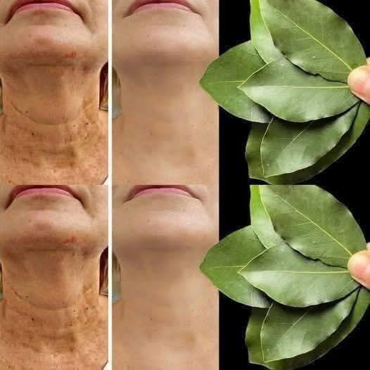 Bay Leaf The Natural Wrinkle Eraser for Ageless Beauty