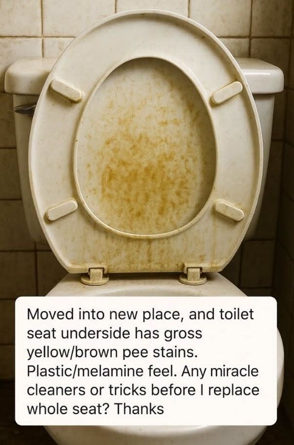 How to Remove Yellow-Brown Stains from a Plastic Toilet Seat (Before You Replace It)