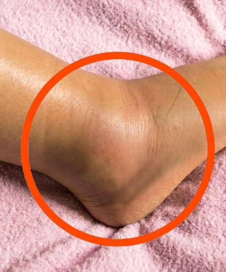 Swollen Legs: What Could It Mean? Common Causes You Should Never Ignore
