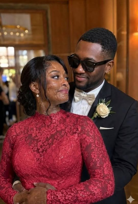 I Married a Blind Man So He’d Never See My Scars – On Our Wedding Night, He Said, ‘You Need to Know the Truth I’ve Been Hiding for 20 Years’