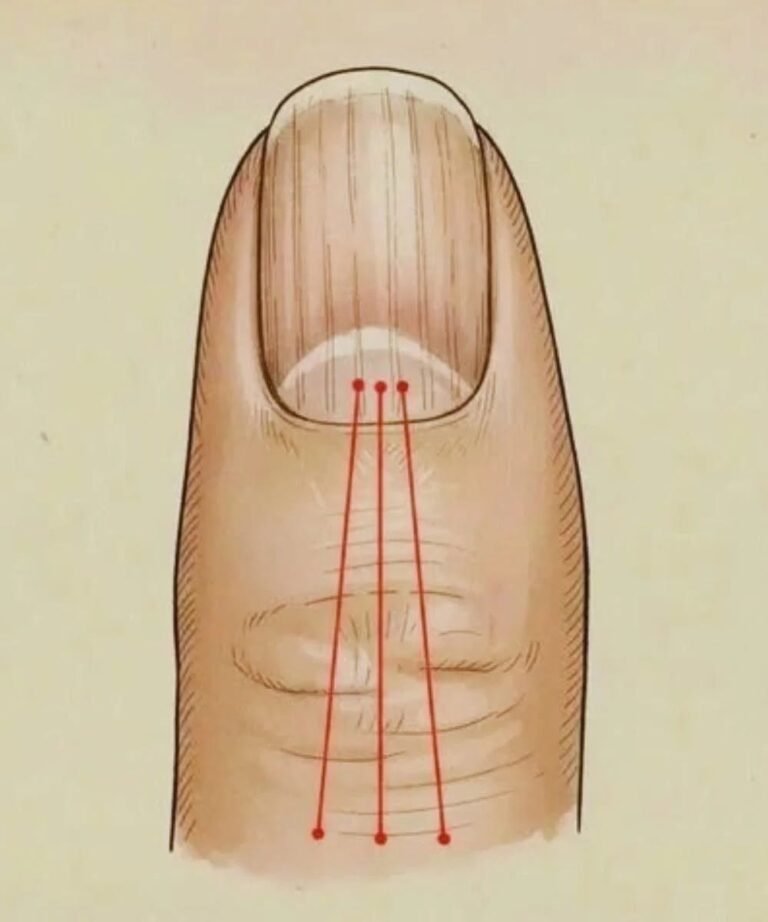 What to Eat to Reduce Nail Ridges: A Nutrition Guide for Healthier Nails