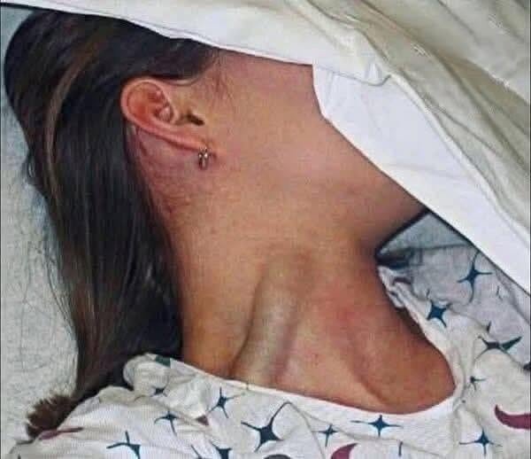 Young Woman’s Tragic Death Sparks Global Warning About Hidden Menstrual Health Risks!!!