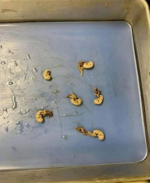 Beware the “Seeds in Your Snack”: How Hidden Threats Can Lurk in Everyday Foods