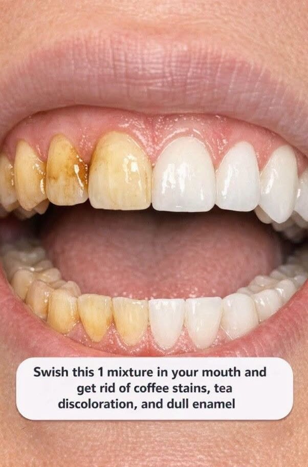 Swish this 1 mixture in your mouth and get rid of coffee stains, tea discoloration, and dull enamel