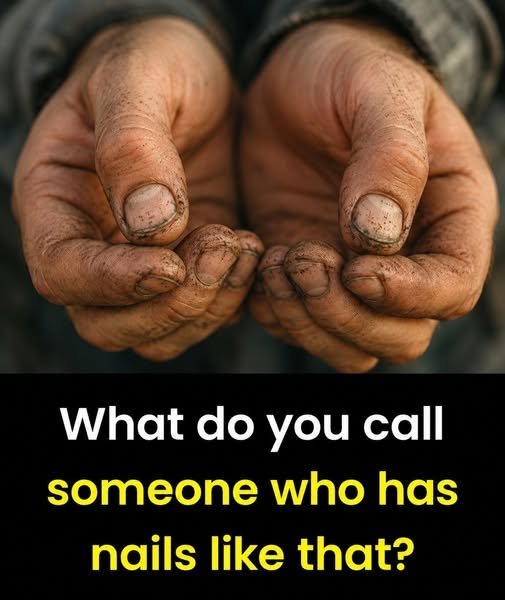 What do you call a person with nails like that?