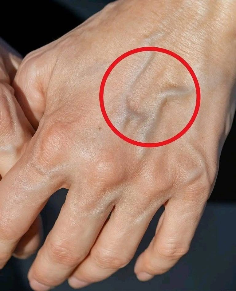 If you have visible veins it means you are… see more