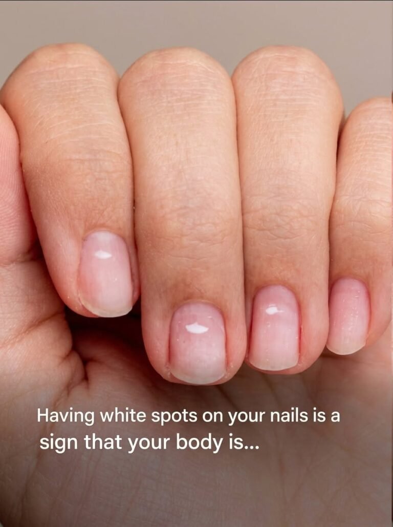 Having white spots on your nails is a sign that your body is…See more
