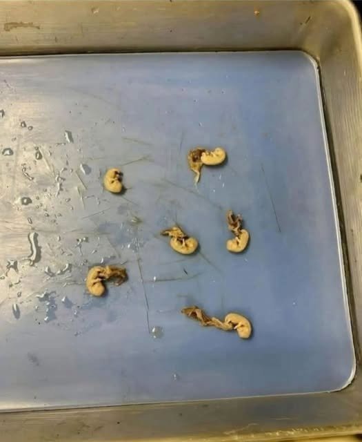 They Thought It Was Nothing—Until They Looked Closer