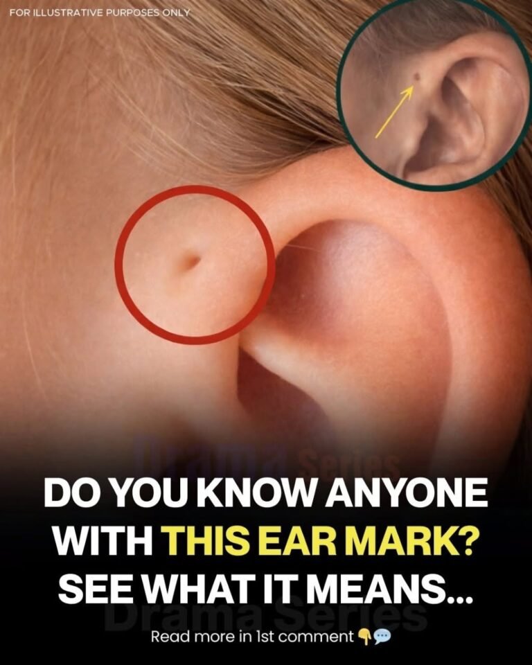 Do You Have This Tiny Hole Above Your Ear? The Fascinating Science Behind a Rare Body Quirk