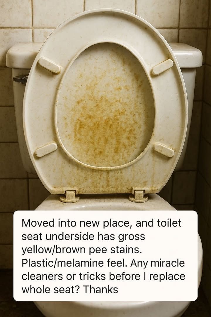 Moved into new place, and toilet seat underside has gross yellow/brown pee stains. Plastic/melamine feel. Any miracle cleaners or tricks before I replace whole seat? Thanks!
