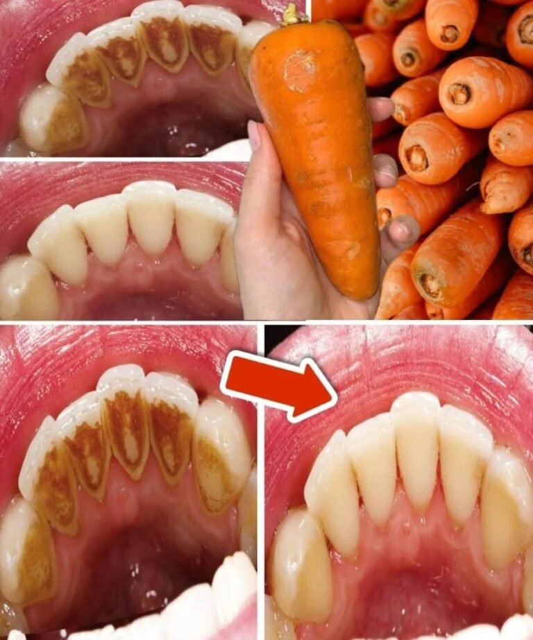 How to Remove Dental Plaque at Home Without Visiting the Dentist