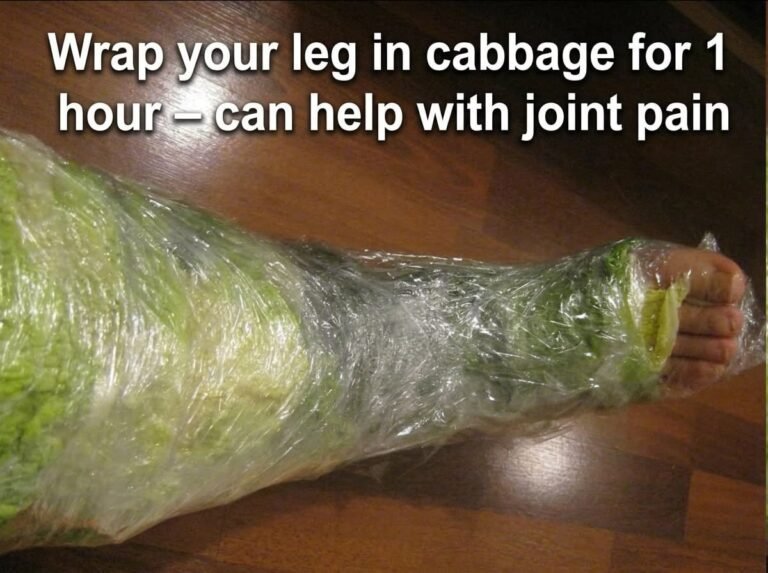 Wrap your leg in cabbage for 1 hour – can help with joint pain