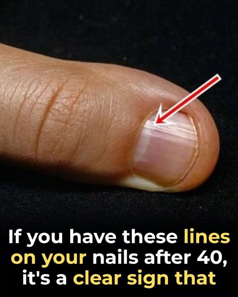 The Best Foods for Stronger Nails After 40