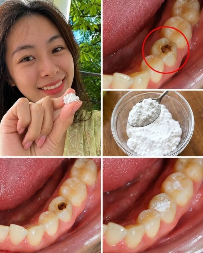 Keep these tips in mind to avoid visiting the dentist 🦷 How to naturally repair a cavity