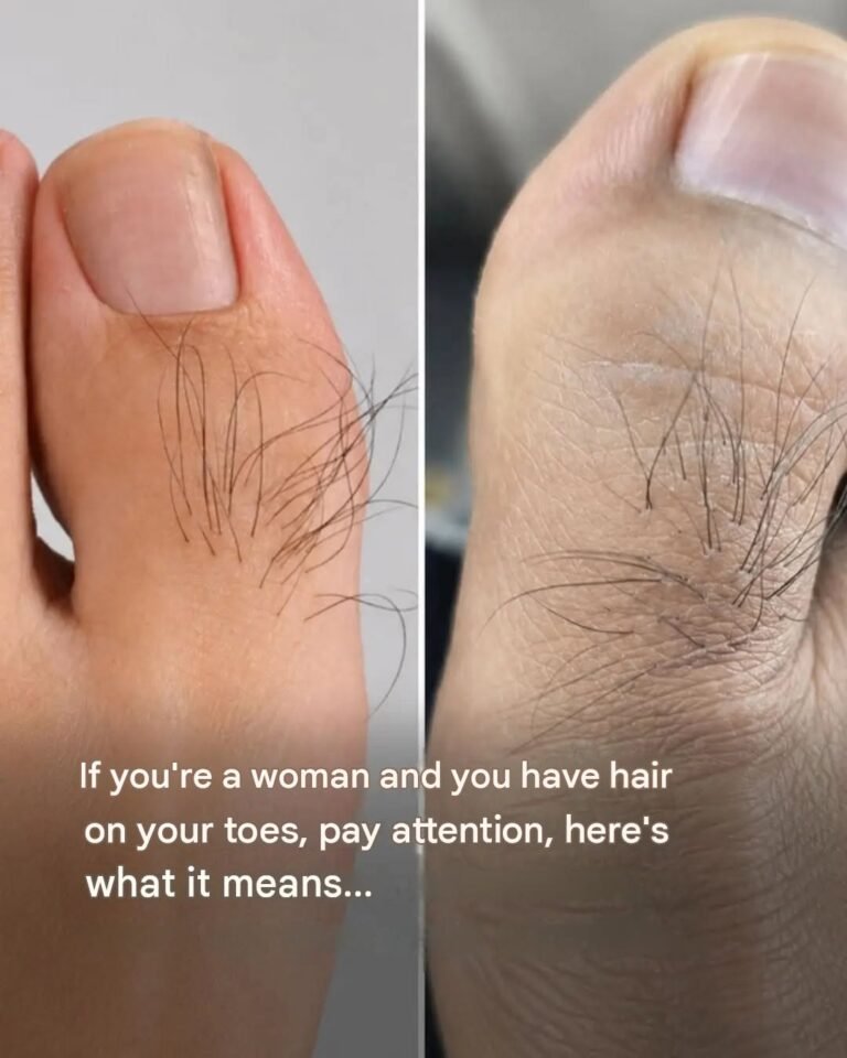 Many women are unaware of what toe hair reveals. See more