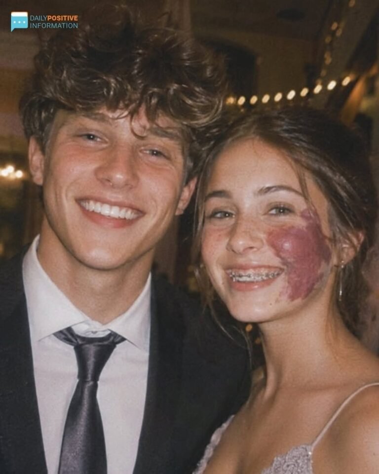 Only One Boy Asked Me To Prom Because Of My Birthmark—Until An Officer Walked In