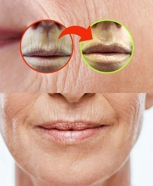 WRINKLES ON THE MOUTH, NO NEED TO WASTE TIME WITH CREAMS: THE REMEDY IS IN THE PANTRY