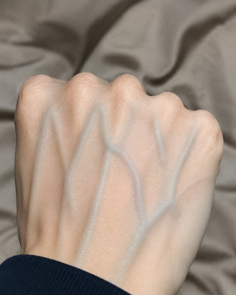 What the Veins on Your Hands Might Reveal About Your Kidney Health