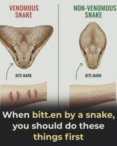 What to do if you are bitten by a snake: important first steps