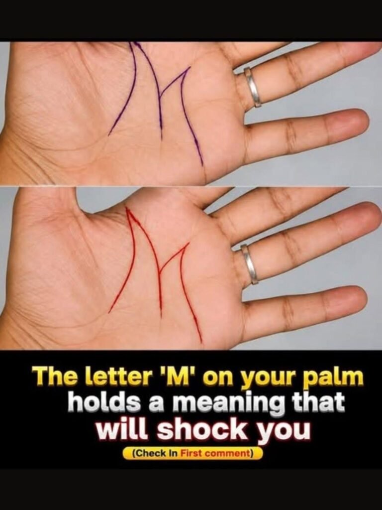 The “M” Line on Your Palm