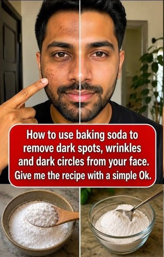 Baking Soda on the Face: Benefits, Risks, and How to Use It Safely…