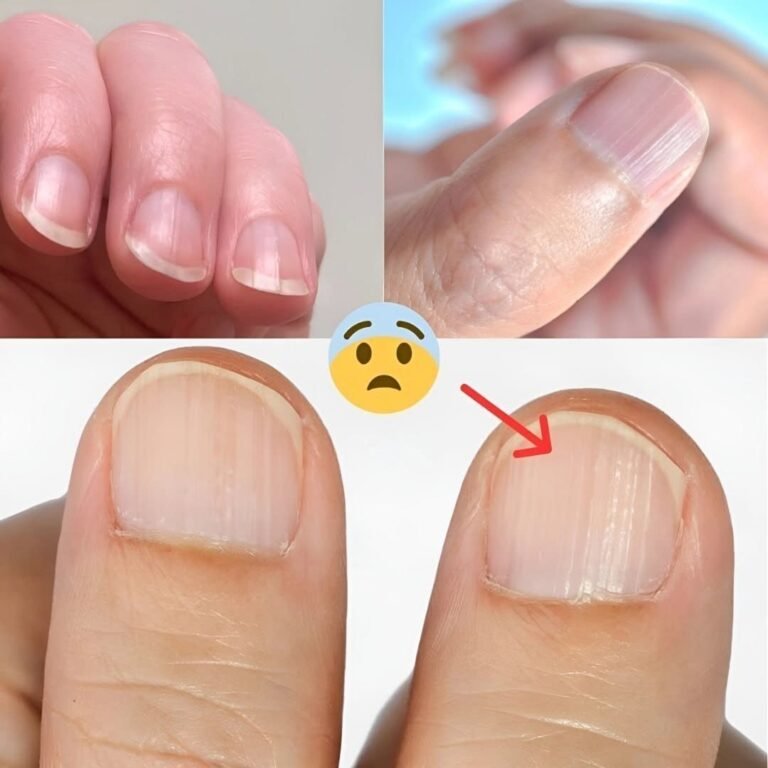 Doctor Reveals 7 Health Issues Hidden in Your Nails
