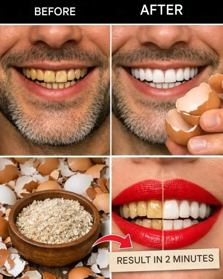 After 5 minutes, the yellow color of the TEETH becomes PEARLY WHITE and shiny – Method in the first comment