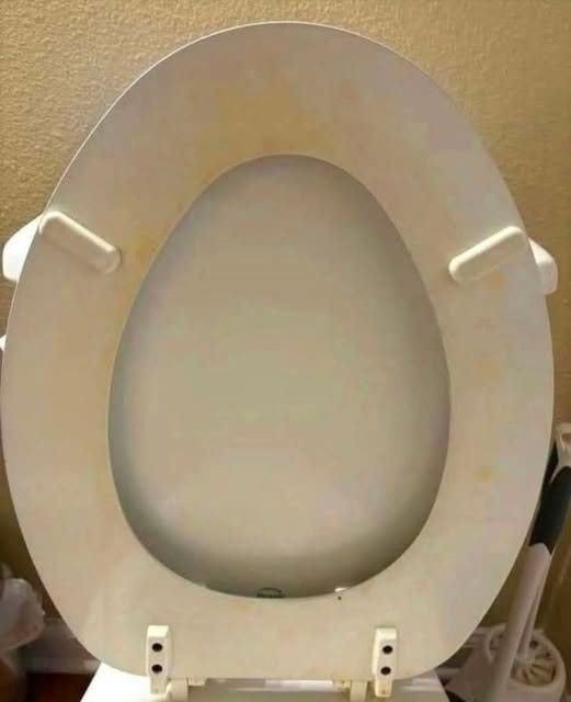 That Gross Yellow Ring? Here’s How I Actually Got Rid of Toilet Stains
