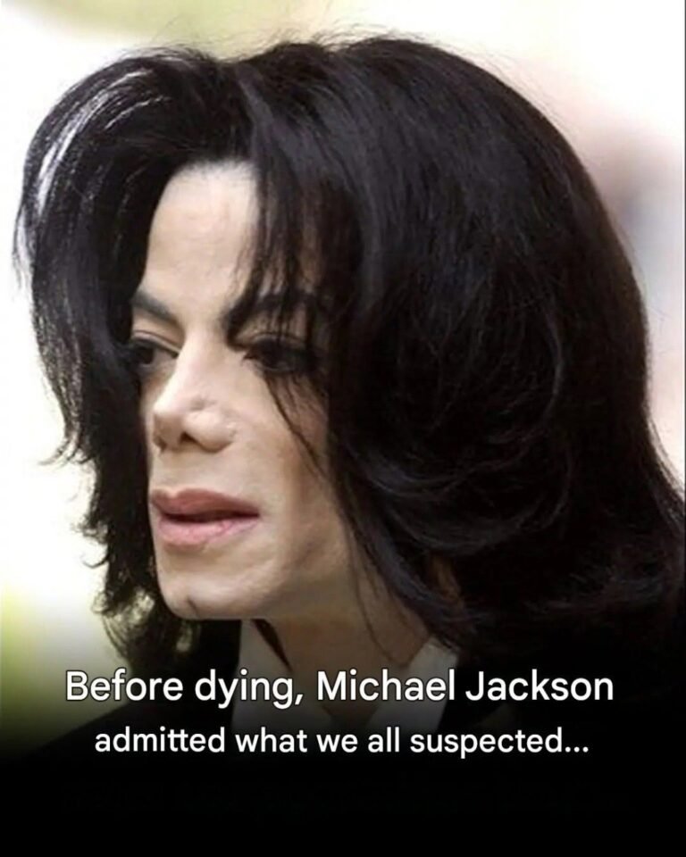 Michael Jackson: What is vitiligo, the disease that affected the King of Pop?